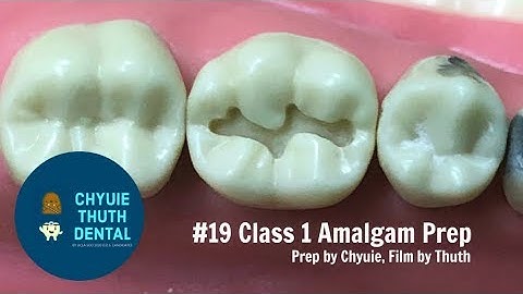 [ChyuieThuth] #19 Class 1 Amalgam Prep