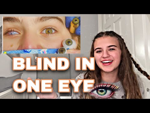 Video: Blind In One Eye: Potentiella Orsaker Och Behandling