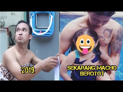 Video: 5 Selebritas Yang Kita Cintai Meski Penampilan Mereka Cacat