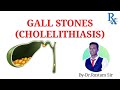 MEDICINE/SURGERY/PATHO- GALL STONES CHOLELITHIASIS BY DR RUSTAM SIR @MBBS/BAMS/BHMS/BUMS/AYUSH