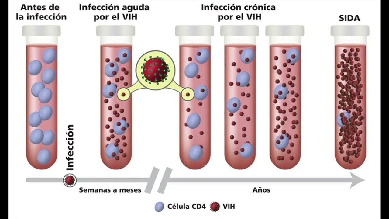 Human immunodeficiency virus. Стадия инкубации ВИЧ. Прогрессирование ВИЧ. Стадия инкубации ВИЧ картинки. HIV AIDS.