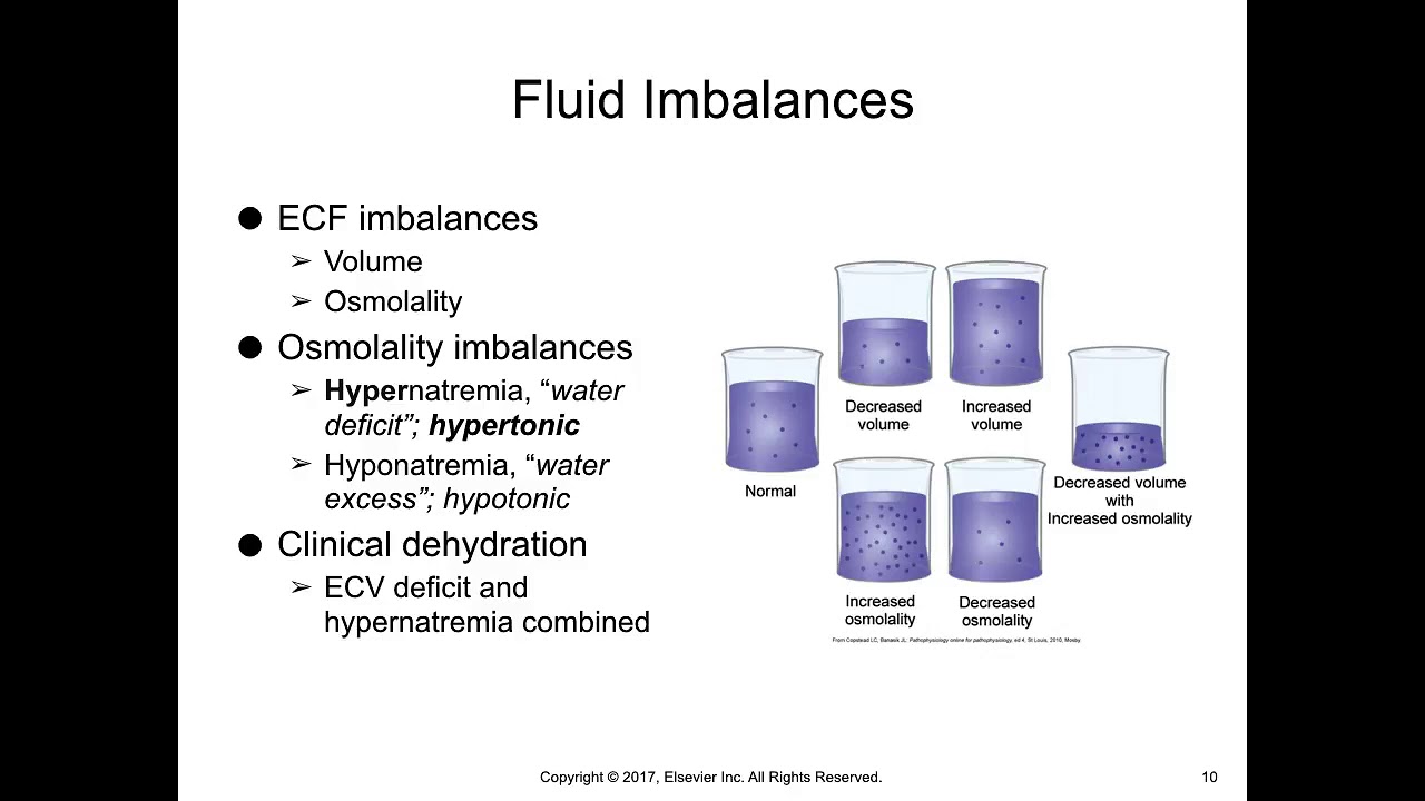 Fundamentals of Nursing Practice- Fluid, electrolytes and acid base balance