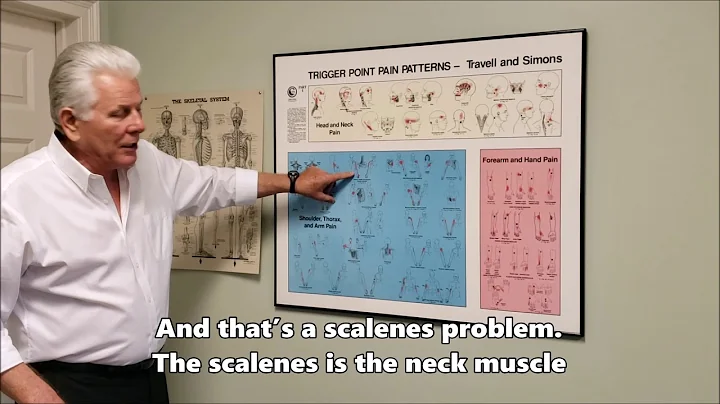 Trigger Points explained by Dr. Russell Janssen, C...