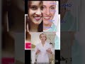 кто верит Дубинской? сколько вас?#нос #фейсфитнес #гимнастикадлялица #массажлица #фейсйога #отеки