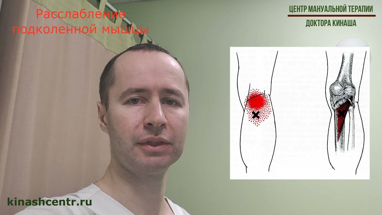 Расслабление подколенной мышцы. Боль в коленном суставе. Киста Бейкера ...