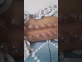 physiotherapy #shortsfeed #viralvideo