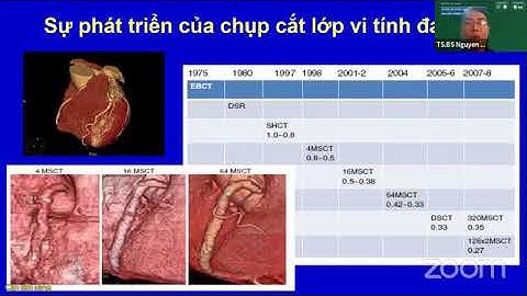CHẨN ĐOÁN HÌNH ẢNH BỆNH TIM THIẾU MÁU CỤC BỘ | TS. BS. NGUYỄN KHÔI VIỆT