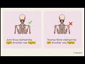 Watch this video - Richard III’s Scoliosis Revisited: Reliability of Historical Sources