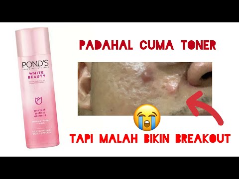 Hallo   Di segment battlein aja kali ini aku mau bandingin Ponds White Beauty Skin Perfecting Karena. 