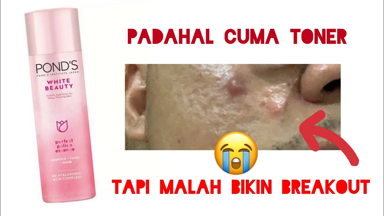 ponds wb essence tnr 3in1