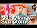 KIDNEY DAMAGE EARLY SYMPTOMS You Need To Know Before It&#39;s Too Late - Foamy Urine, Diabetes and More