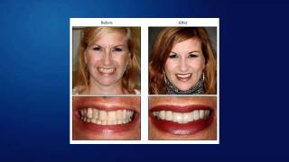 Menlo Park Dentistry on How to Tell If You Got Quality Dentistry