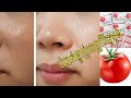 បំបាត់ស្បែកមុខខ្លាញ់ | How to reduce oil from your face | How to stop oil on face