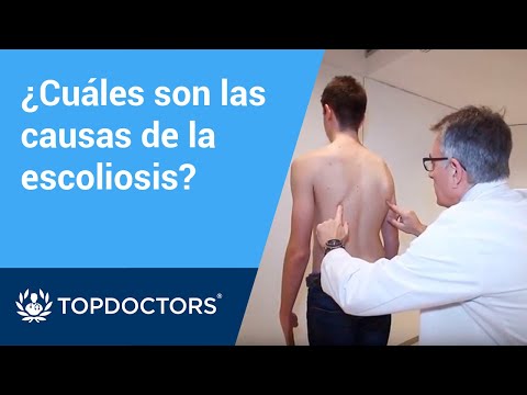 Video: ¿Es mala la escoliosis toracolumbar?