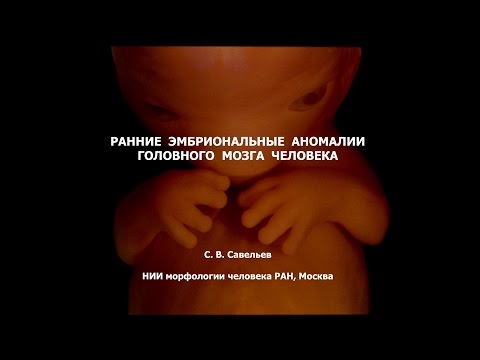 С.В. Савельев: эмбриональные аномалии мозга человека