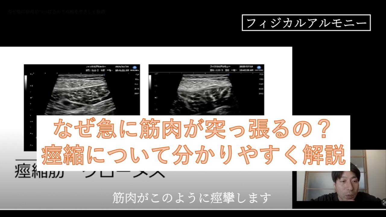 なぜ急に筋肉がつっぱるの？痙縮をやさしく解説