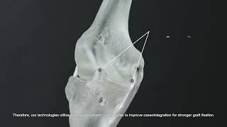 Artificial Ligament for Hard-Soft Tissue Repairing screenshot 5