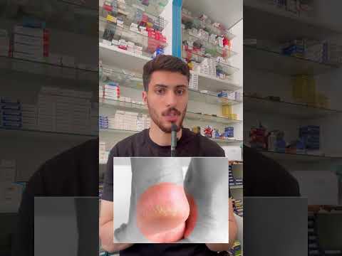 حاجات فالصيدليه سعرها رخيص بس هتنعفك كتير اوي ادوية صيدليه  اكسبلور التهاب