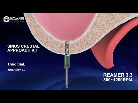 京達Biomate鼻竇提升器-Sinus Crestal Approach ＫＩＴ