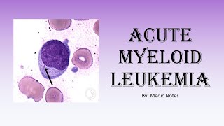 [Hematology] Acute myeloid leukemia, Auer rods, treatment screenshot 4