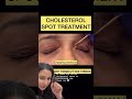 Xanthelasma treatment. #shorts #dermshorts