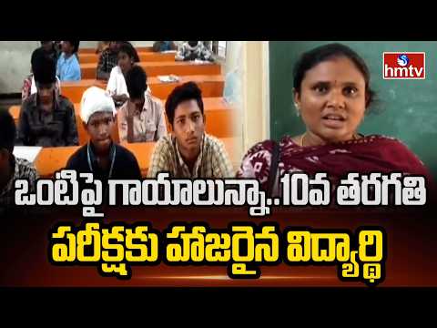 ఒంటిపై గాయాలున్నా..10వ తరగతి పరీక్షకు హాజరైన విద్యార్థి | Tirupati Dist Srikalahasti | hmtv