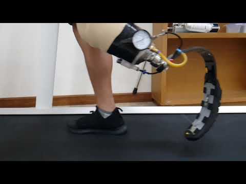 chân giả dưới gối chạy thể thao