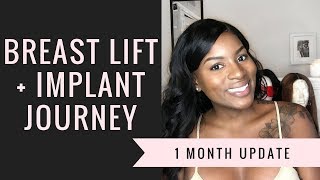 BREAST LIFT & IMPLANT 1 MONTH UPDATE