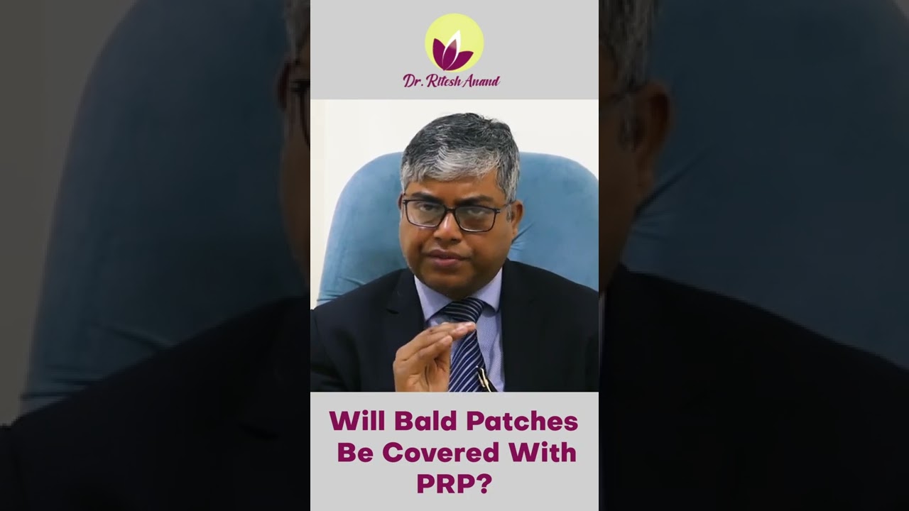 💥 Bald Patches Cover with PRP | Dr. Ritesh Anand  | 