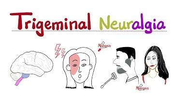 Trigeminal Neuralgia - Tic Douloureux - Painful tics, Painful spasms - Headache 🤕 - Neuro