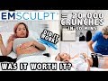 I TRIED THE "INSTANT ABS" PROCEDURE | MY EMSCUPLT EXPERIENCE (BEFORE & AFTER)