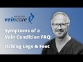 Symptoms of a vein condition faq leg itching