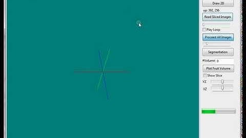 StarFruit MRI Reconstruction Using Lazarus Programming and OpenGL