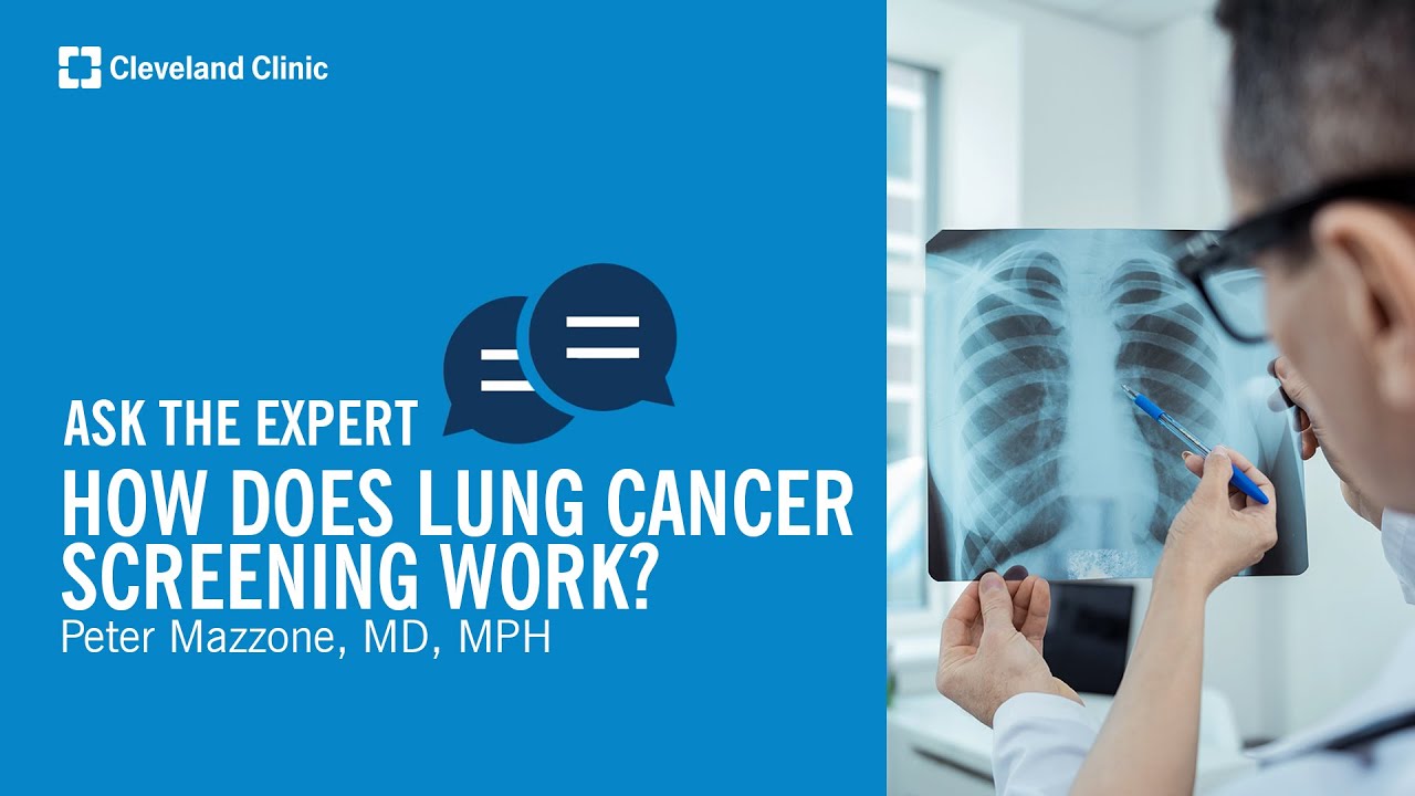 How Does Lung Cancer Screening Work? | Ask Cleveland Clinic’s Expert ...