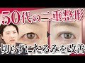 【50代の埋没法】症例解説！まぶたのたるみを二重整形で解消？切らずに若返る【湘南美容外科】