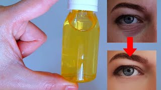 الزيت السحري ⁉️ لعلاج الهالات السوداء ‼️والتجاعيد  أسفل العين ‼️ يعطي نتائج رائعة