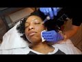 HOW I MINIMIZED MY PORES IN 24 HOURS!!! | Microneedling Experience