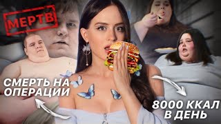 Тайны шоу "Я ВЕШУ 300 КГ" | Сломанные жизни, жестокость, см*рти в операционной