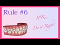 Ipr  do it right   invisalign mini course 7 of 8 part i