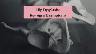 Hip dysplasia key signs and symptoms