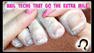 👣 XXX Extreme Dead Skin Removal Toenail Transformation Pedicure Tutorial