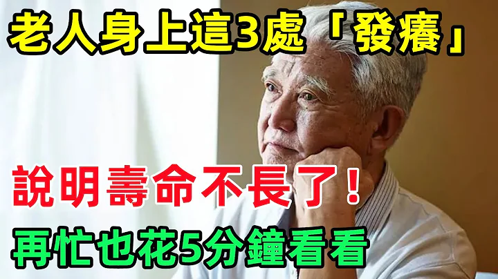 老人身上这3处「发痒」，说明寿命不长了！如果你一个都不占，活到100岁没问题！#国学#俗语#国学智慧#佛学#佛说#佛法#佛学知识#人生感悟#人生哲理#佛教故事 - 天天要闻