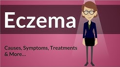 Eczema -  Causes, Symptoms, Treatments & More… 
