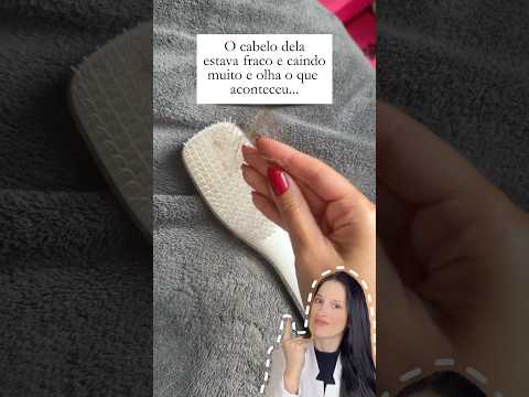 O cabelo dela está caindo muito na hora de pentear e no banho… Até que… ￼