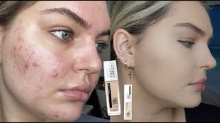 Maybelline Super Stay Full Coverage Foundation Review 😬