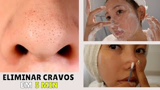 GET RID OF "BLACKHEADS" EASILY IN 5 MINUTES! screenshot 5