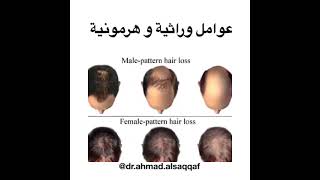 دكتور أحمد السقاف Dr.Ahmad Alsaqqaf/  تساقط الشعر Hair Loss