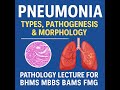 Pathology lesson 23 Pneumonia | Types, Pathogenesis | Pathology Lecture for BHMS MBBS BAMS FMG