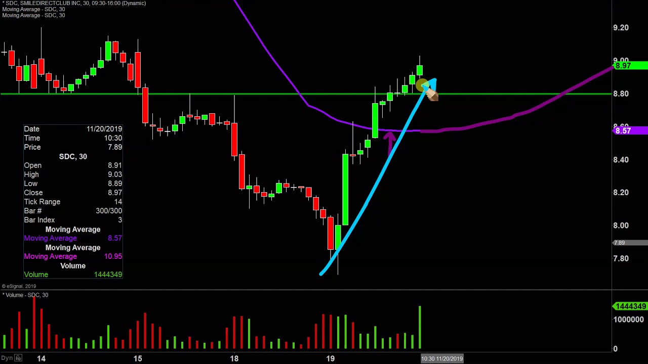 Invisalign Stock Chart