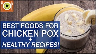 Best Foods for Chicken Pox | Healthy Recipes